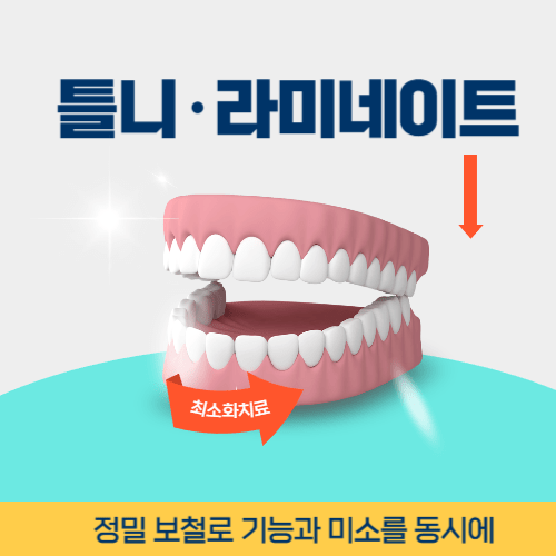 여수치과 여수시 치과 틀니 라미네이트
