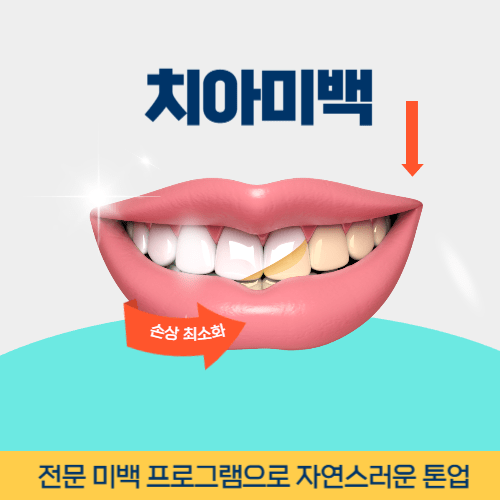 여수치과 여수시 치과 치아미백